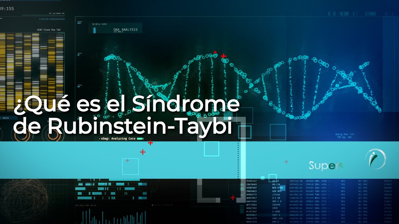 sindrome rubinstein taybi esperanza de vida