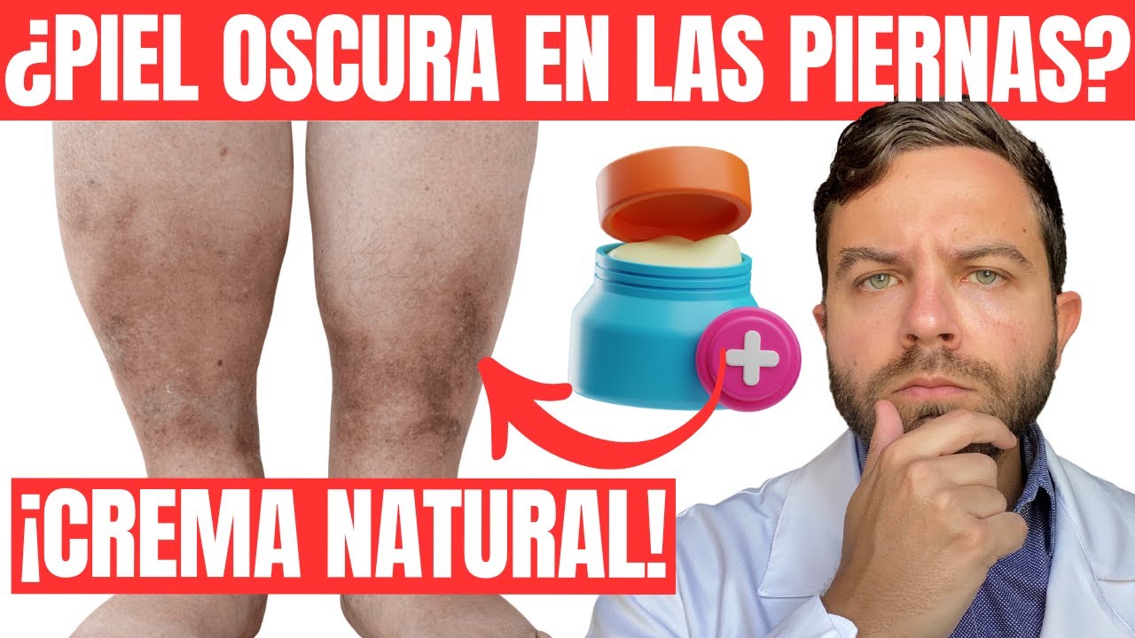 como quitar las manchas de las piernas