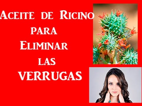 el aceite de ricino elimina las verrugas
