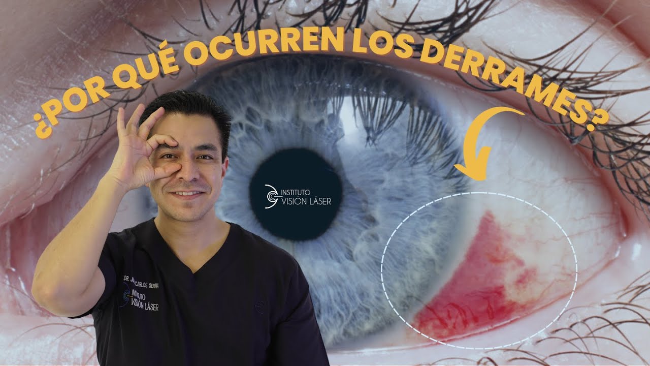 manchas rojas debajo de los ojos