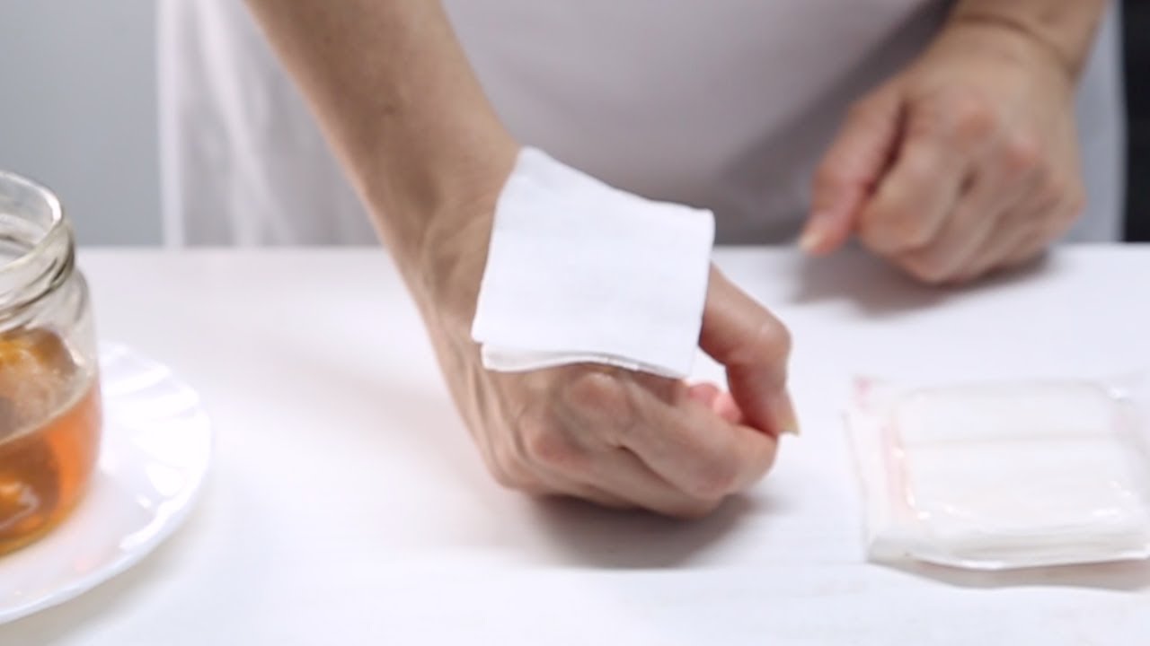 remedio casero para quemaduras de horno