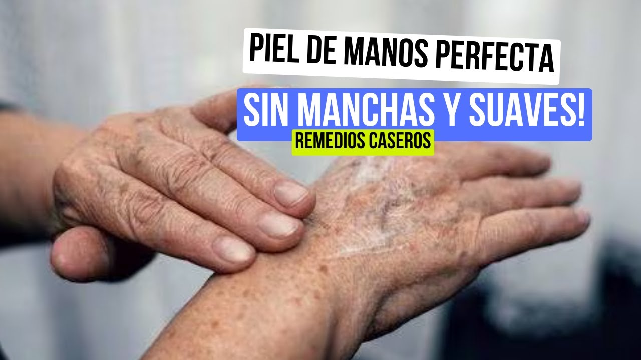 remedio casero para quitar las manchas de las manos