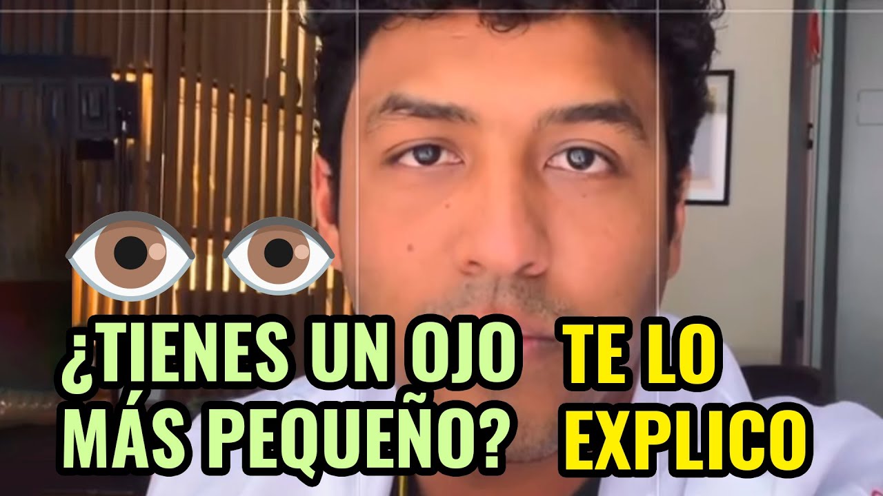 tengo un ojo mas grande que el otro