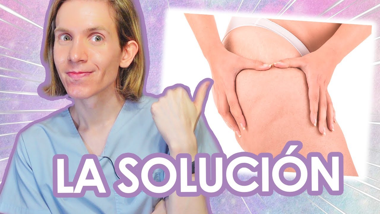 como perder celulitis de las piernas