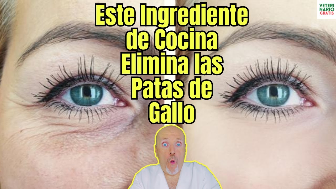 como quitar las patas de gallo en los ojos