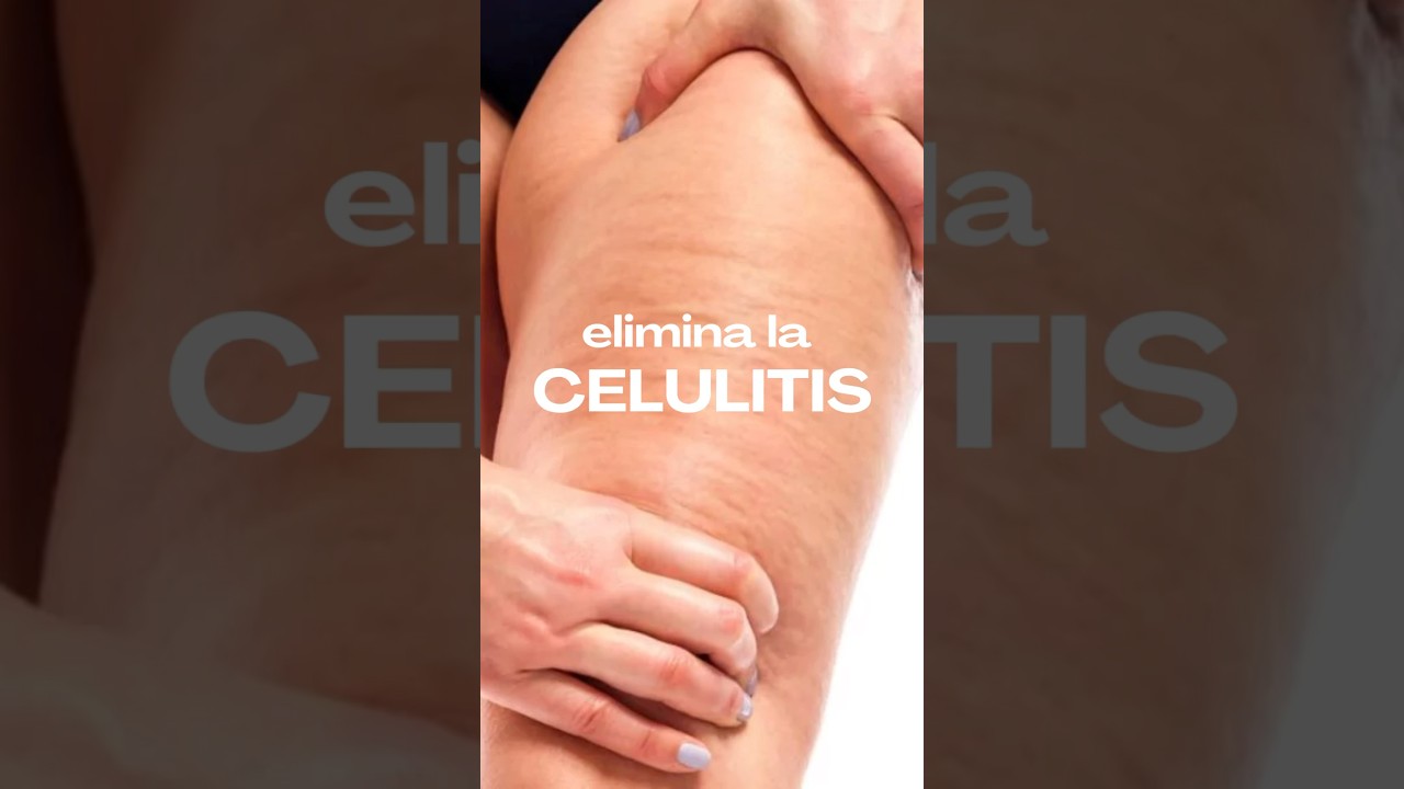 como se puede eliminar la celulitis