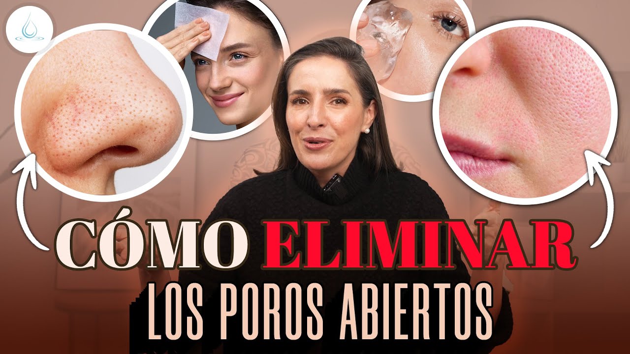 tratamiento para piel grasa y poros abiertos